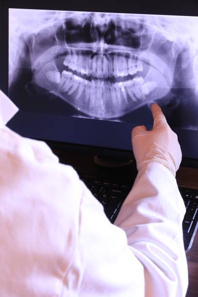 Best Emergency Gum Treatment in Level Park Oak Park, MI